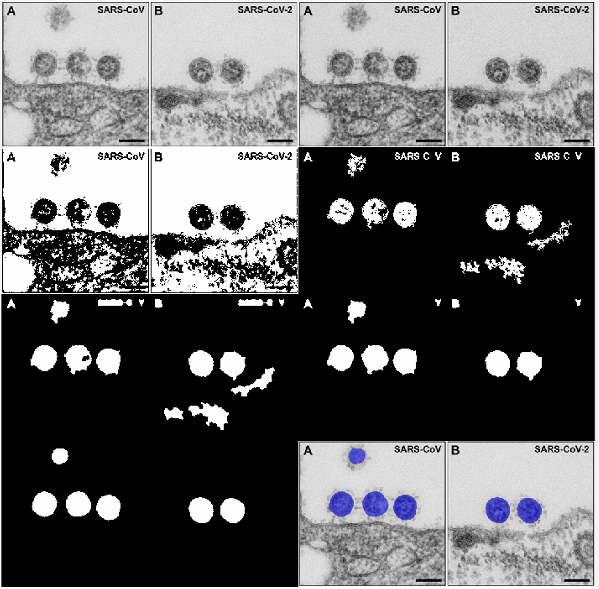 Training images - pipeline of image processing the raw TEM images to masking the